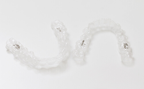 Invisalign® Invisalign teen®